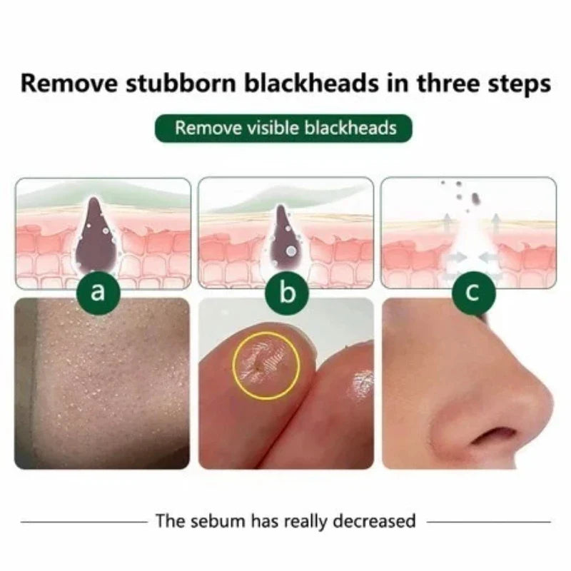 Glowingly Clear Skin Set